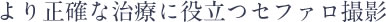 より正確な治療に役立つセファロ撮影