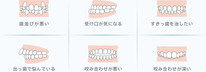 「歯並びが悪い」「受け口が気になる」「すきっ歯を治したい」「出っ歯で悩んでいる」「咬み合わせが悪い」「かみ合わせが深い」