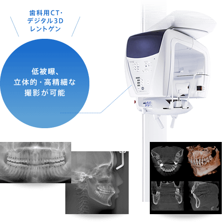 低被曝、立体的・高精細な撮影が可能 歯科用CT・デジタル3Dレントゲン