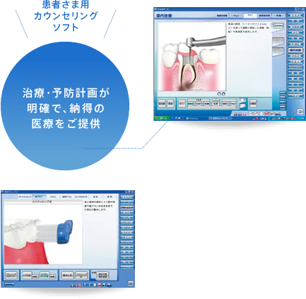 治療・予防計画が明確で、納得の医療をご提供 患者さま用カウンセリングソフト